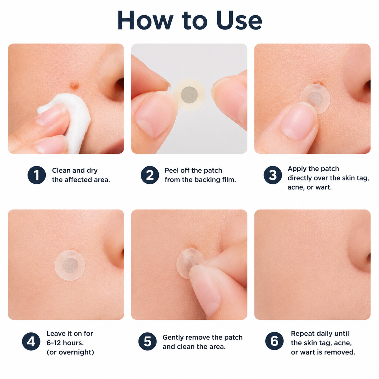 Curalona®2-in-1 Microneedle & Hydrocolloid Patch🍀| Removes Raised Moles, Acne, Flat Warts & Skin Tags | Helps Improve Wrinkles, Scars & Blemishes | Invisible Patches for Face & Body