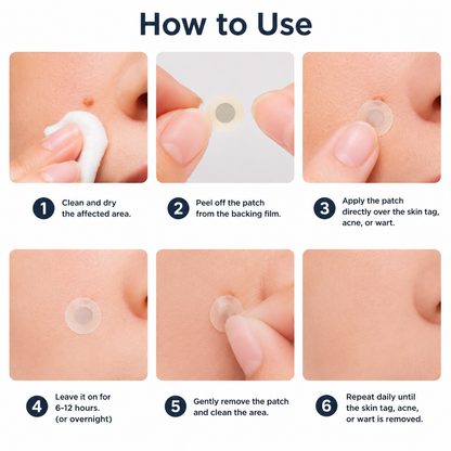 Curalona®2-in-1 Microneedle & Hydrocolloid Patch🍀| Removes Raised Moles, Acne, Flat Warts & Skin Tags | Helps Improve Wrinkles, Scars & Blemishes | Invisible Patches for Face & Body