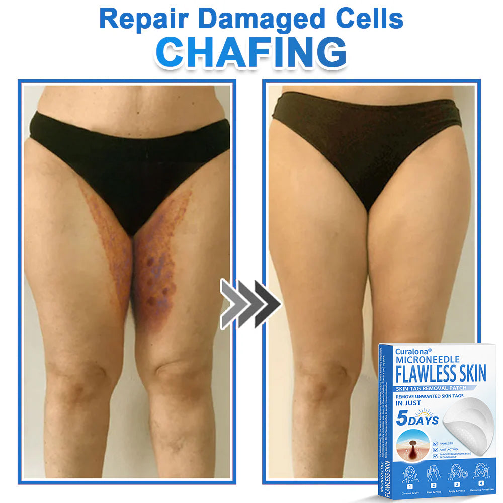 🩹 Curalona® 2-in-1 Microneedle & Hydrocolloid Patch | Raised Moles,Acne,  Flat Warts & Skin Tags Remover | Improves Wrinkles, Scars & Blemishes | Invisible Pimple Patches for Face & Body